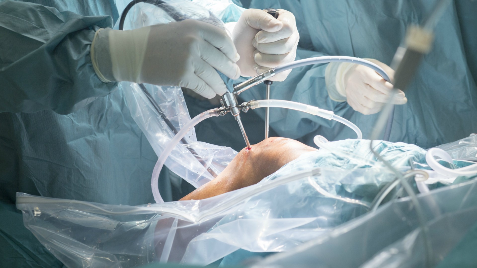 chirurgi care tratează articulațiile